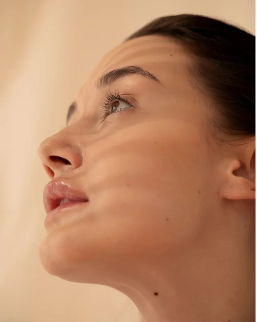 HYNIDASE® 1500iu filler dissolver in suffern ny