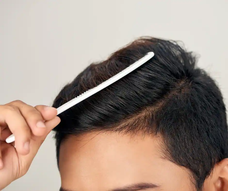 healthy scalp of man after Alopecia Areata Treatment Airmont, NY