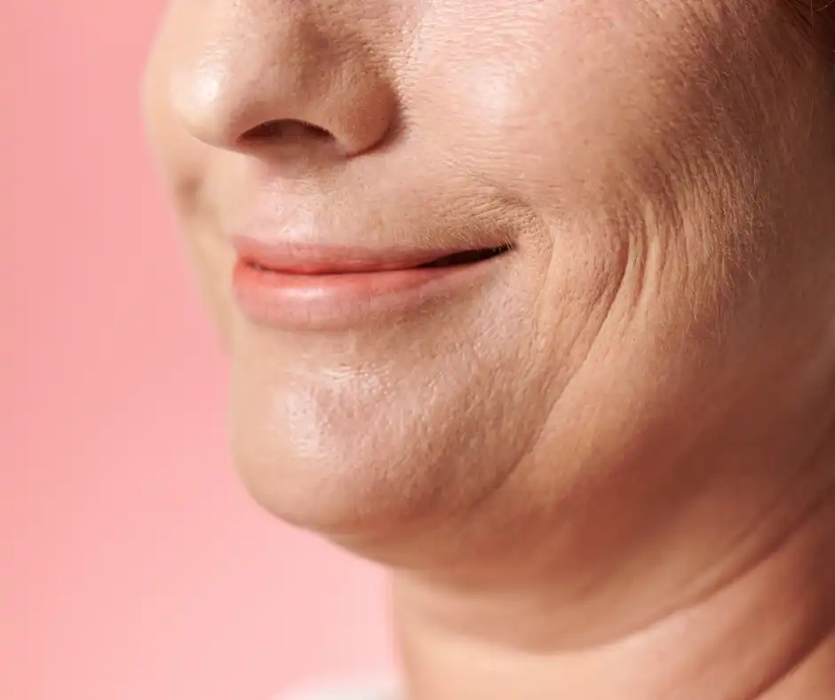jowls treatment