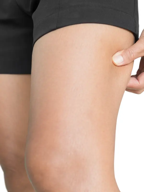 smooth thigh of a woman without chicken skin