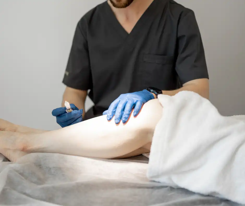 sclerotherapy procedure
