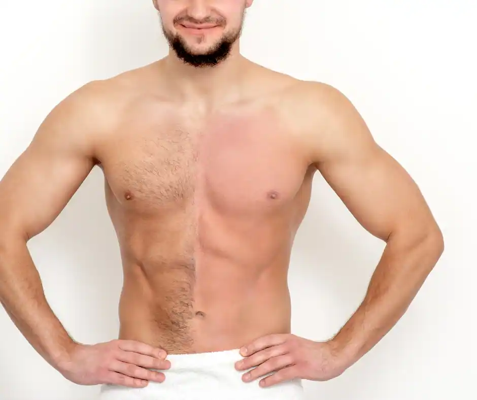 chest laser hair removal for men in Airmont New York