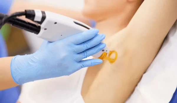 laser hair removal cost