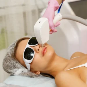 Facial Hair Removal Treatment for someone with Sensitive Skin